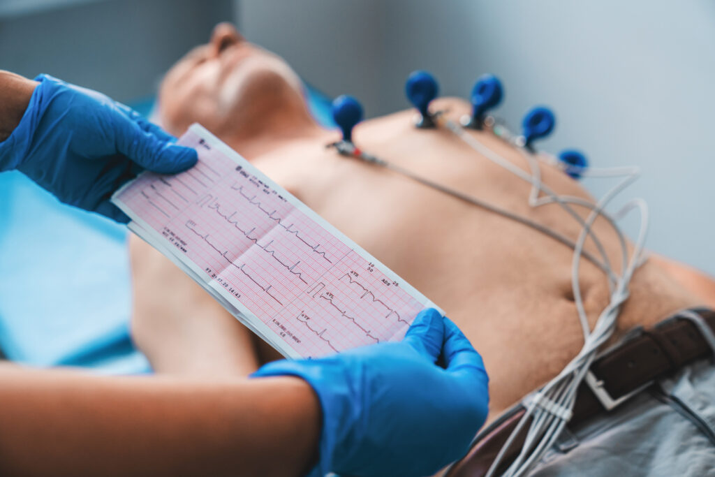 ECG test in Sarjapur,