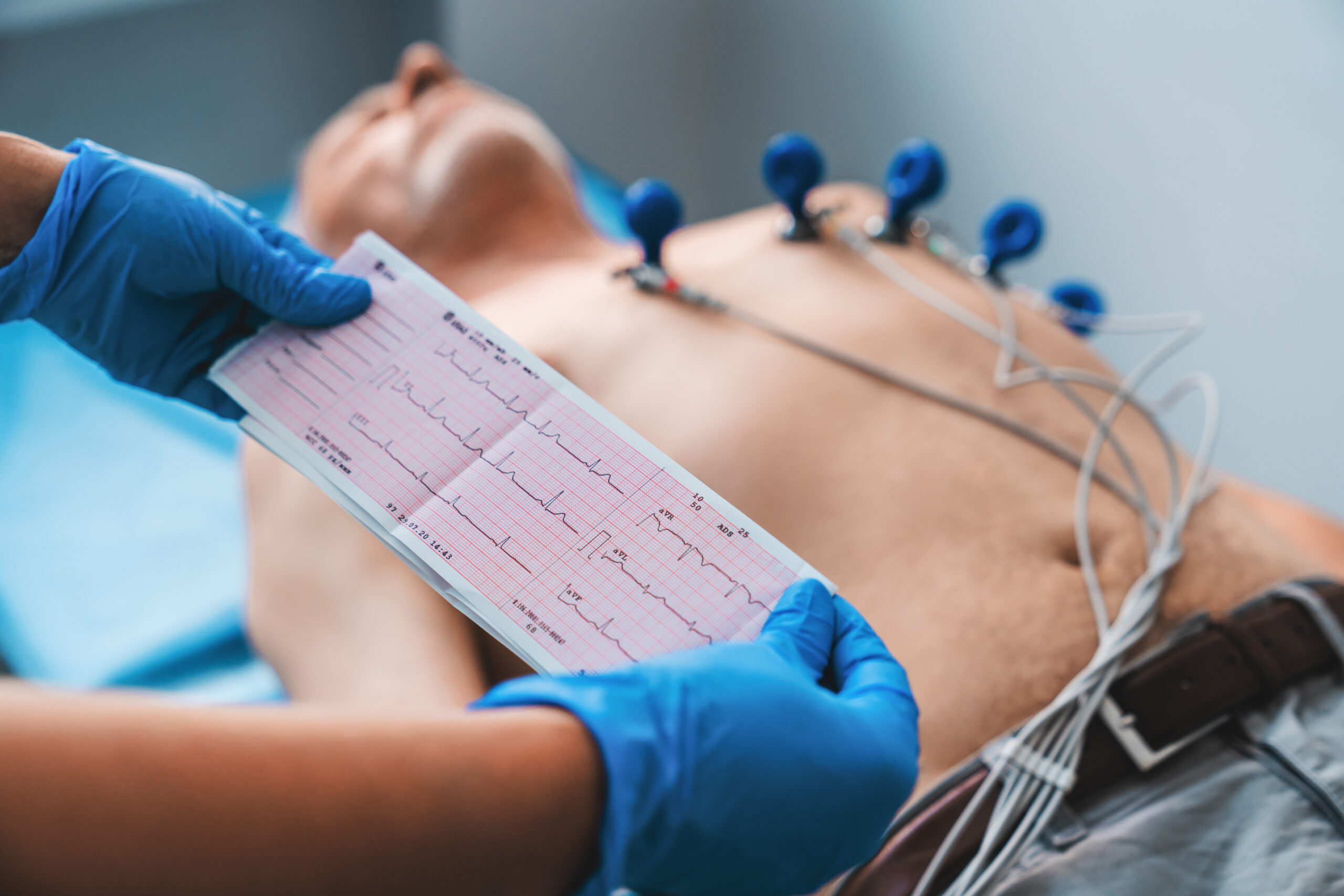 ECG test in Sarjapur,