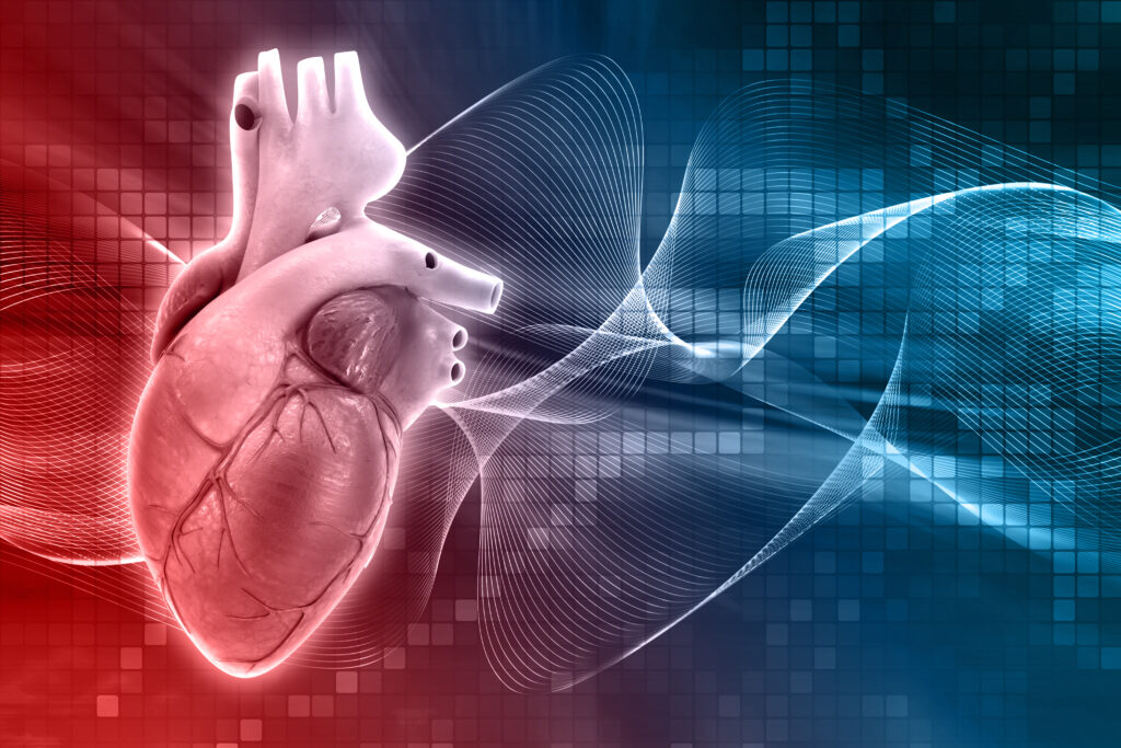 Angioplasty in Electronic City