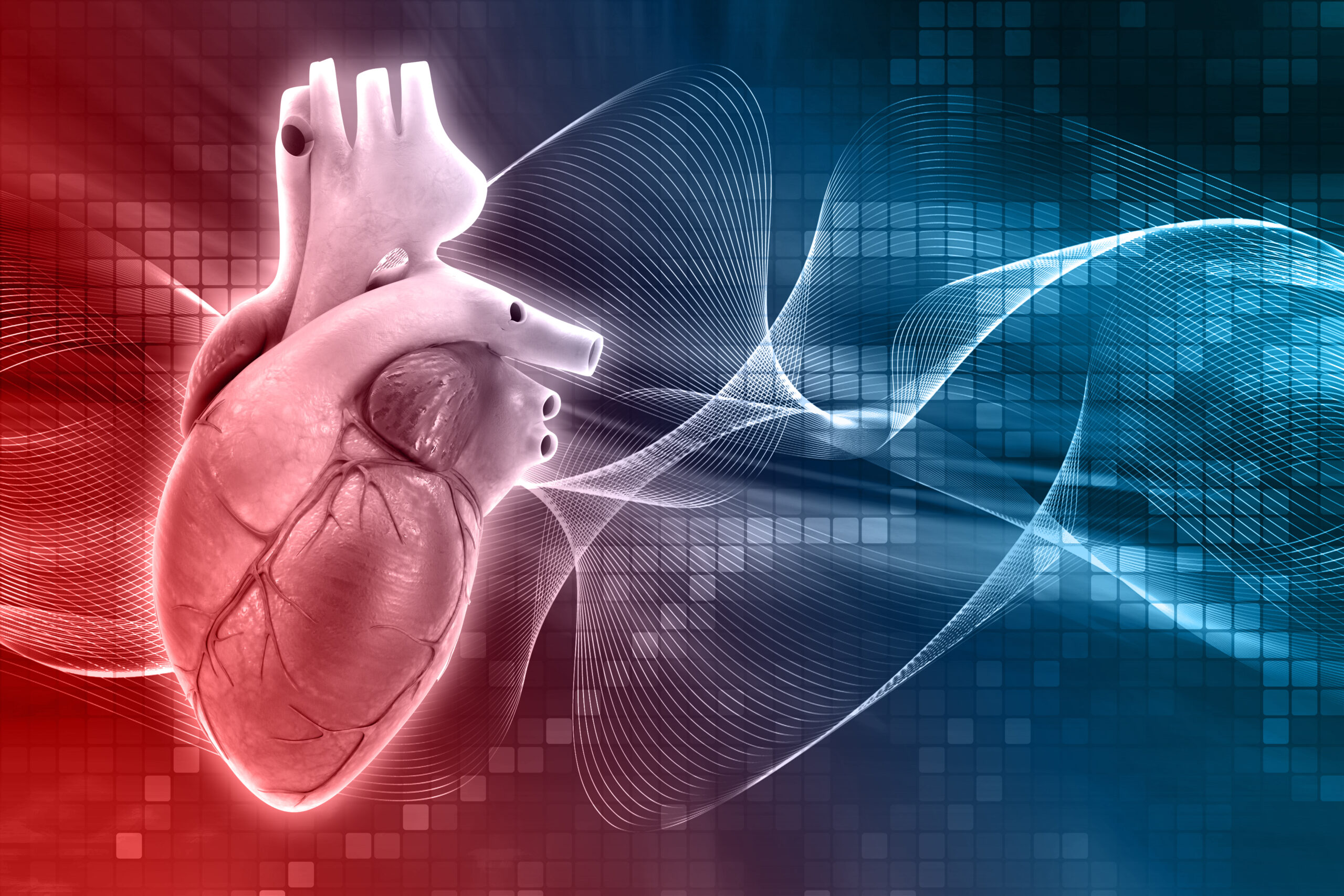 Angioplasty in Electronic City